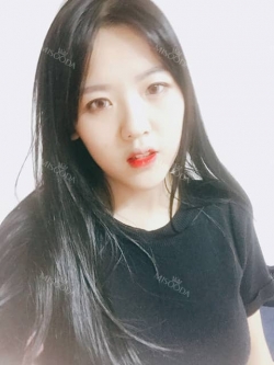 Chin Fillers! — Korea cost, reviews & before-after | MISOODA