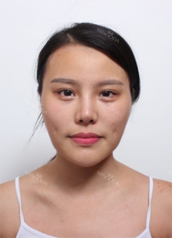 Misooda — Korea cost, reviews & before-after | MISOODA