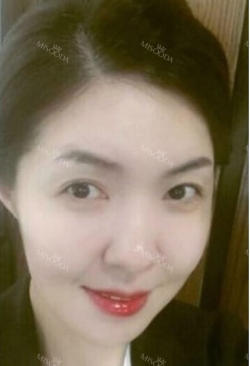 Stem cell Fat grafting + Smile V Lifting + Laser Lifting — Korea cost, reviews & before-after | MISOODA