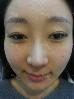 Misooda — Korea cost, reviews & before-after | MISOODA