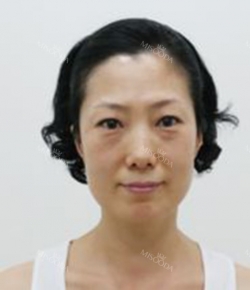 Misooda — Korea cost, reviews & before-after | MISOODA