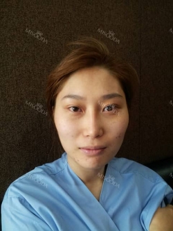 Misooda — Korea cost, reviews & before-after | MISOODA