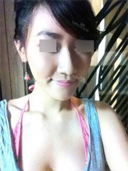 Misooda — Korea cost, reviews & before-after | MISOODA