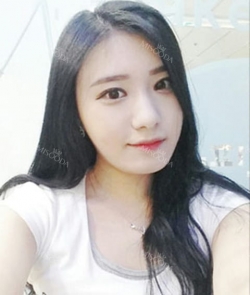 facial contouring — Korea cost, reviews & before-after | MISOODA