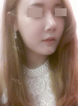 Misooda — Korea cost, reviews & before-after | MISOODA