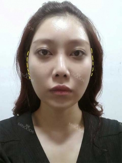 Misooda — Korea cost, reviews & before-after | MISOODA