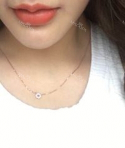 my beautiful lips — Korea cost, reviews & before-after | MISOODA