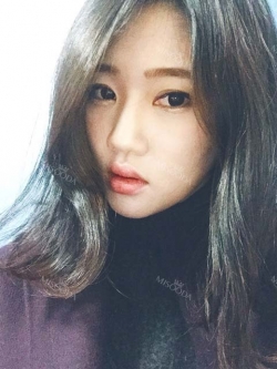 Two-jaw + Ar + Zy + T + Front zygoma(sil) + forehead (sil) + calibration O (ceramic) — Korea cost, reviews & before-after | MISOODA