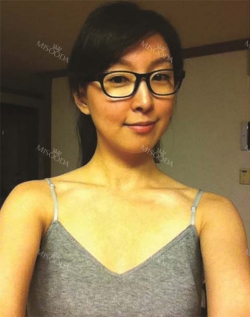 The most natural and suitable size for me! — Korea cost, reviews & before-after | MISOODA