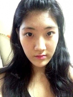 I had eager for a nice face since I was a little girl. — Korea cost, reviews & before-after | MISOODA