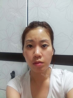 It was my dream to have a perfect face... — Korea cost, reviews & before-after | MISOODA