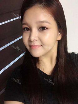 fg (forehead, zygoma), ni (fat), rhino (using donated cartilage and if more is needed ear cartilage) — Korea cost, reviews & before-after | MISOODA