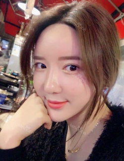 Ar + Zy + T + LP (jaw line) + thread lifting + (tack) Rhino (re) — Korea cost, reviews & before-after | MISOODA