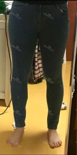 Thigh Liposuction + Calf Reduction — Korea cost, reviews & before-after | MISOODA