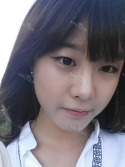 After 3 months of Eye, Nose, Fat grafting Surgery — Korea cost, reviews & before-after | MISOODA
