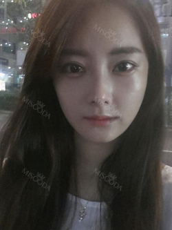 Eye, Nose, Micro Fat Grafting, Facial bone contouring surgery — Korea cost, reviews & before-after | MISOODA
