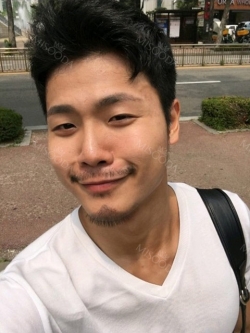 The typical Asian eyes — Korea cost, reviews & before-after | MISOODA