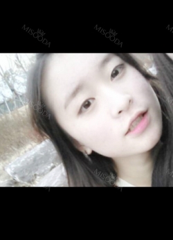 22 year old double eyelid check my photos — Korea cost, reviews & before-after | MISOODA