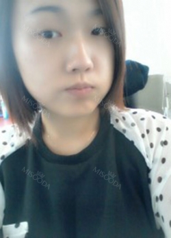 Incision double eyelid surgery, epi and lateral canthoplasty, Jawline toxin — Korea cost, reviews & before-after | MISOODA
