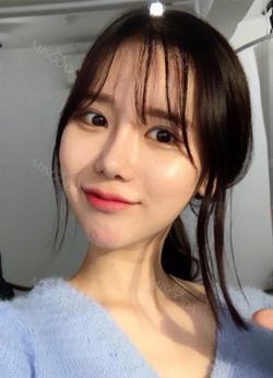 Incision Ptosis, Nose Revision, Cheek Bone, Square Jaw, Thread Lifting, Buccal Fat Removal — Korea cost, reviews & before-after | MISOODA