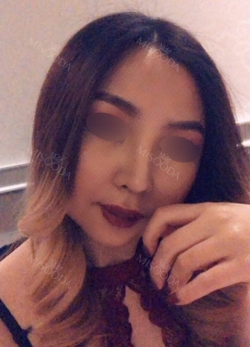 Eye, Nose, Facial contouring at View — Korea cost, reviews & before-after | MISOODA