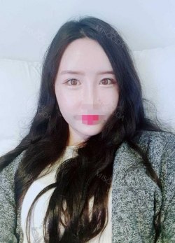 fat graft + nonincisional NI ptosis correction — Korea cost, reviews & before-after | MISOODA