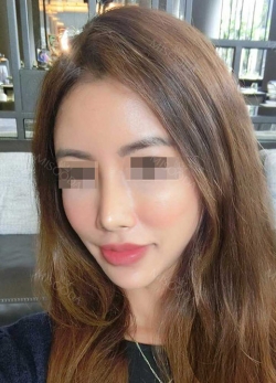 Misooda — Korea cost, reviews & before-after | MISOODA