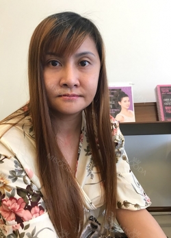 Vline, Cheekbone, Acculift Review at View — Korea cost, reviews & before-after | MISOODA
