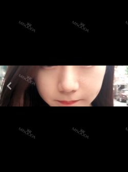 Consulting with the fanous nose revisioning clinic, O&Young — Korea cost, reviews & before-after | MISOODA