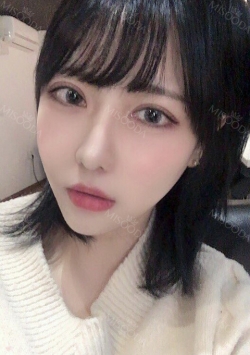 Double Eyelid + Rhinoplasty + Fat Graft + Facial Bone — Korea cost, reviews & before-after | MISOODA