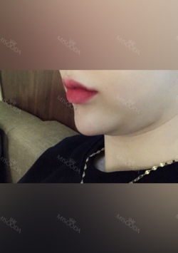 Chin Liposuction — Korea cost, reviews & before-after | MISOODA