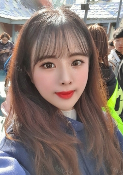 Nose, Eye, Fat Graft After 1 year!!! — Korea cost, reviews & before-after | MISOODA