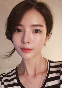 Double eyelids revision & Nose revision :) — Korea cost, reviews & before-after | MISOODA