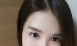 Dark rings be gone! — Korea cost, reviews & before-after | MISOODA