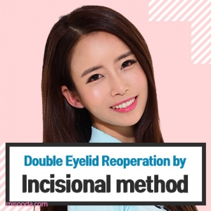 Misooda — Korea cost, reviews & before-after | MISOODA