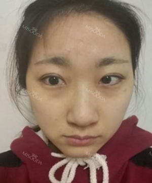 Misooda — Korea cost, reviews & before-after | MISOODA