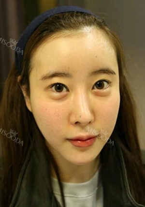 Misooda — Korea cost, reviews & before-after | MISOODA