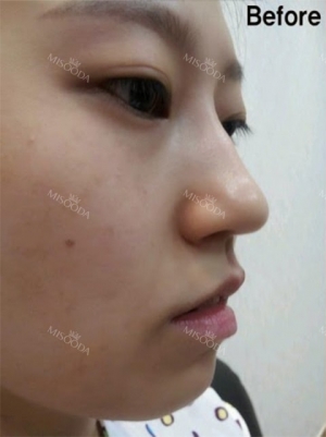 Misooda — Korea cost, reviews & before-after | MISOODA