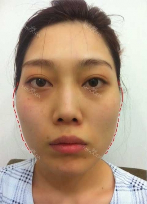 Misooda — Korea cost, reviews & before-after | MISOODA
