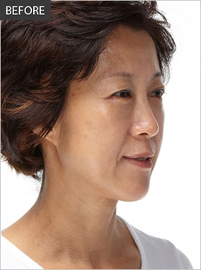 Cella Plastic Surgery, Reviews, Images, Promotions — Korea cost, reviews & before-after | MISOODA