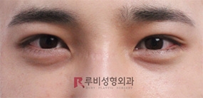 Cella Plastic Surgery, Reviews, Images, Promotions — Korea cost, reviews & before-after | MISOODA