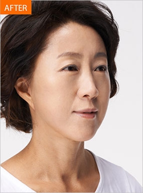 Cella Plastic Surgery, Reviews, Images, Promotions — Korea cost, reviews & before-after | MISOODA