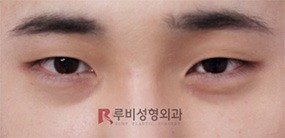 Cella Plastic Surgery, Reviews, Images, Promotions — Korea cost, reviews & before-after | MISOODA