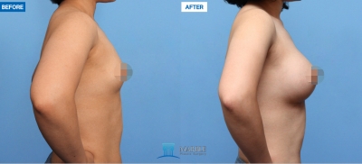 MARBLE Plastic Surgery,Reviews,Images, Promotions — Korea cost, reviews & before-after | MISOODA