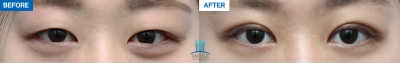 MARBLE Plastic Surgery,Reviews,Images, Promotions — Korea cost, reviews & before-after | MISOODA