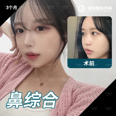 GIRIN Plastic Surgery. GIRIN aesthetic Clinic — Korea cost, reviews & before-after | MISOODA