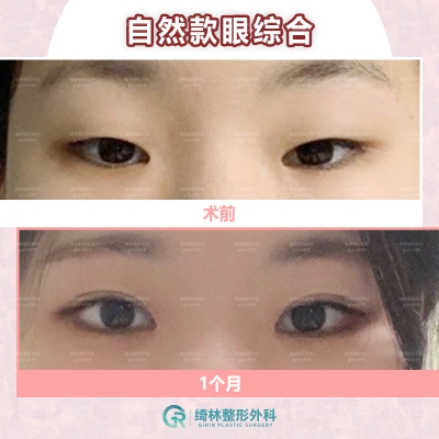 GIRIN Plastic Surgery. GIRIN aesthetic Clinic — Korea cost, reviews & before-after | MISOODA