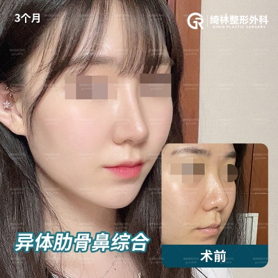 GIRIN Plastic Surgery. GIRIN aesthetic Clinic — Korea cost, reviews & before-after | MISOODA