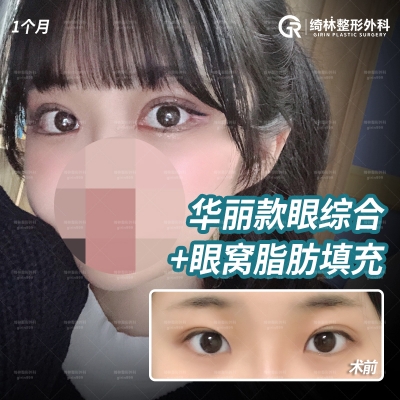 GIRIN Plastic Surgery. GIRIN aesthetic Clinic — Korea cost, reviews & before-after | MISOODA