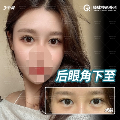 GIRIN Plastic Surgery. GIRIN aesthetic Clinic — Korea cost, reviews & before-after | MISOODA